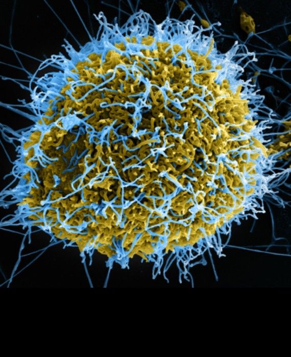 DR Congo reported a fresh Ebola outbreak.